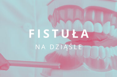 fistuła