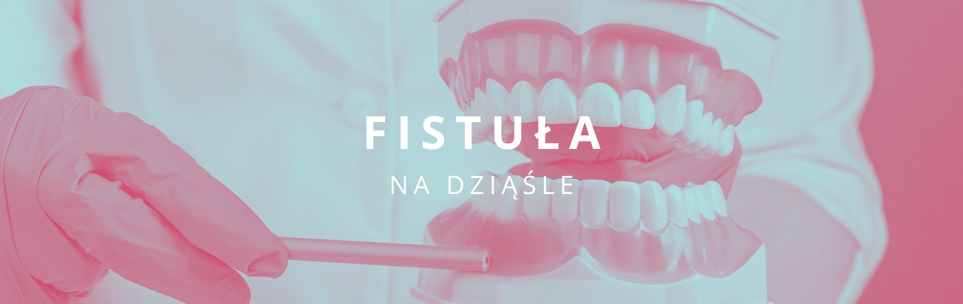 fistuła