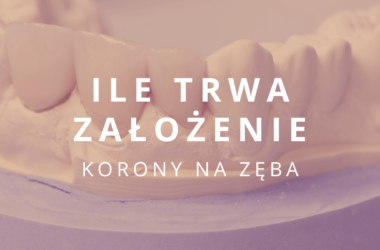 ile trwa założenie korony na zęba