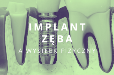 implant zęba a wysiłek fizyczny