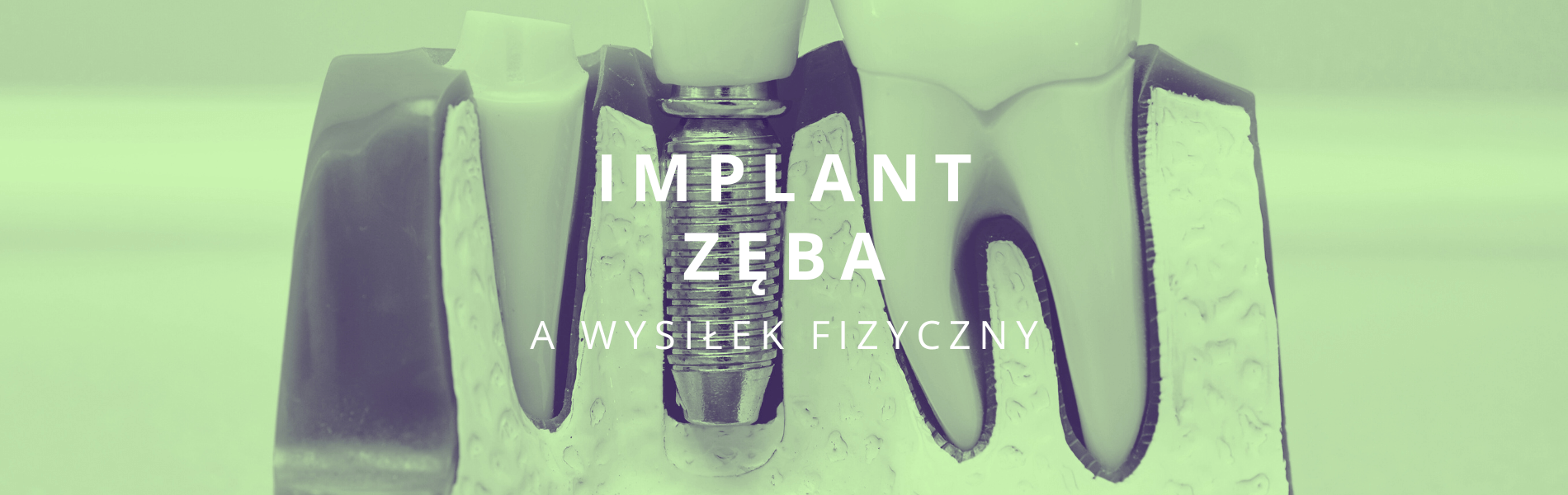 implant zęba a wysiłek fizyczny