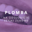 plomba na odsłonięte szyjki zębowe