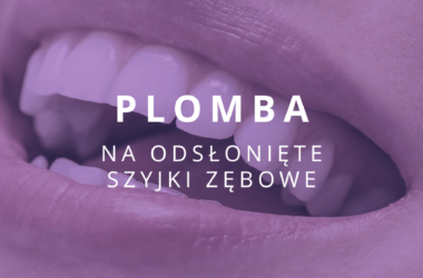 plomba na odsłonięte szyjki zębowe