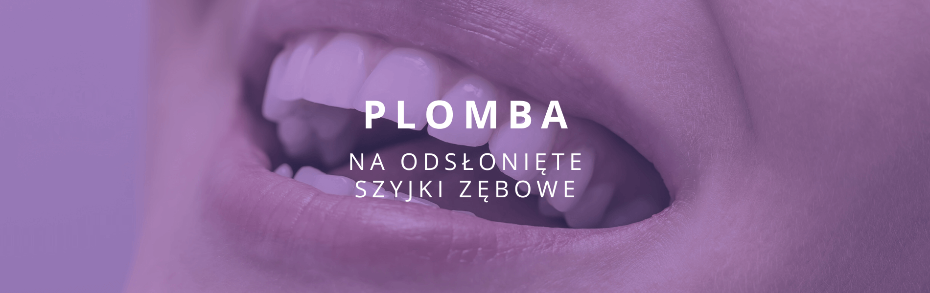 plomba na odsłonięte szyjki zębowe