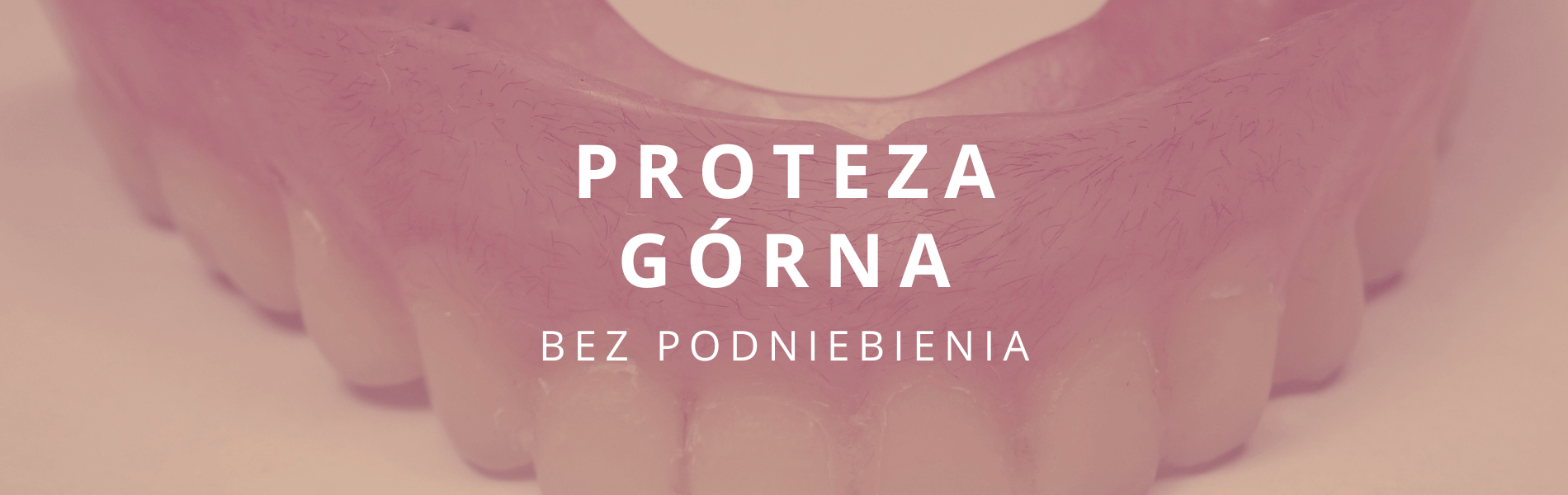 proteza górna bez podniebienia