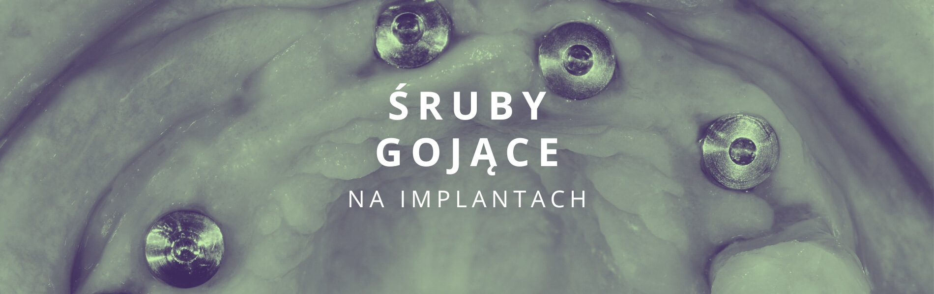 śruby gojące implanty