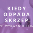 kiedy odpada skrzep po wyrwaniu zęba