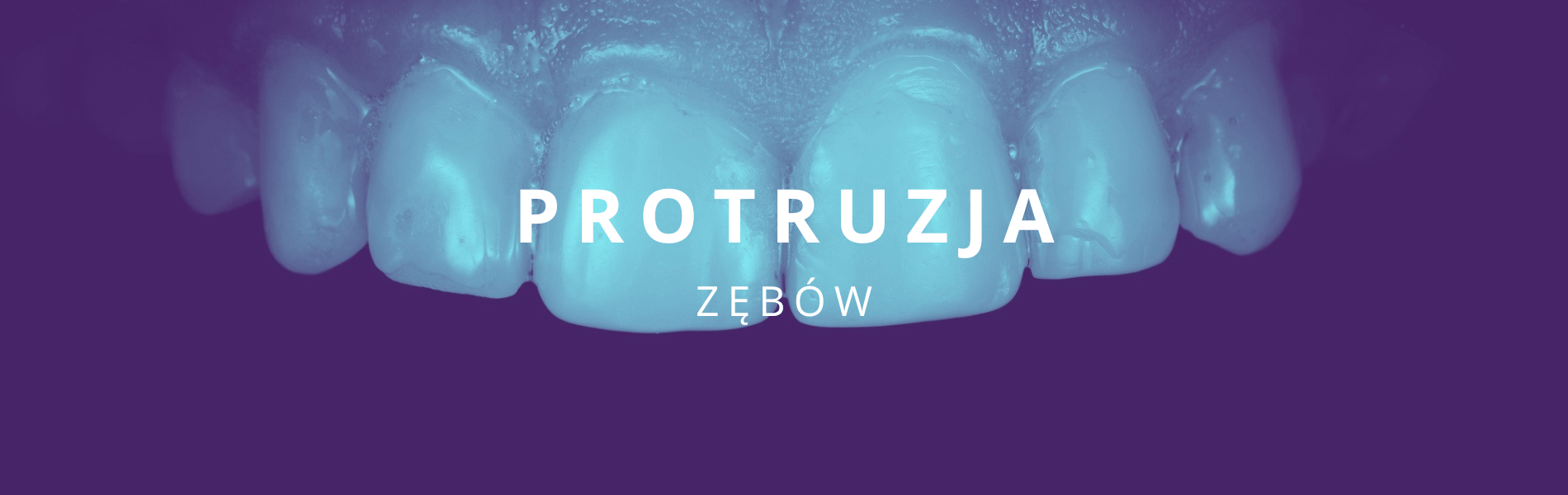 protruzja zębów