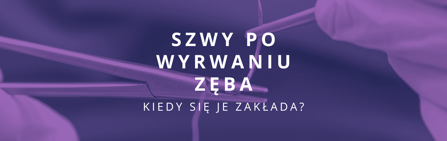 kiedy zakłada się szwy po wyrwaniu zęba