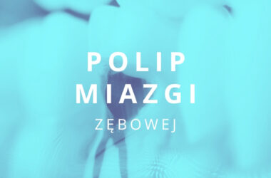 polip miazgi