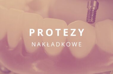 protezy nakładkowe