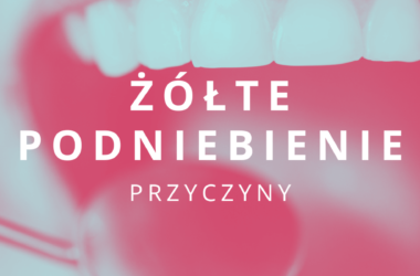 żółte podniebienie