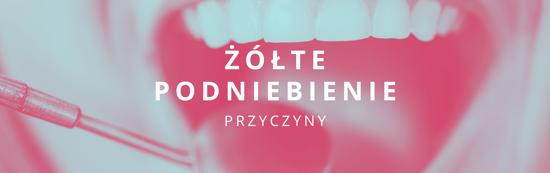 żółte podniebienie