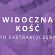 po wyrwaniu zęba widać kość