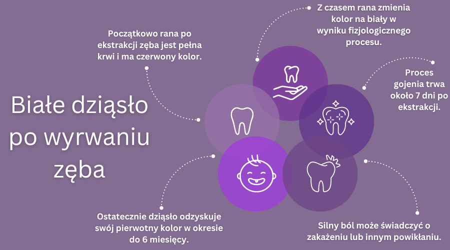 białe dziąsło po wyrwaniu zęba - najważniejsze informacje