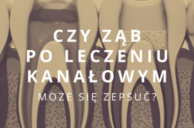 czy ząb po leczeniu kanałowym może się zepsuć