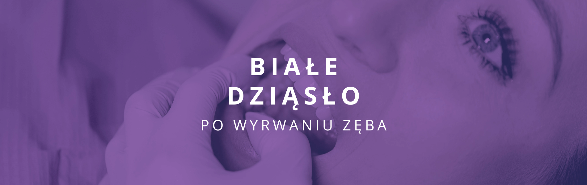 dziąsło po wyrwaniu zęba białe