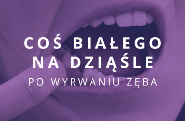 po wyrwaniu zęba widać coś białego