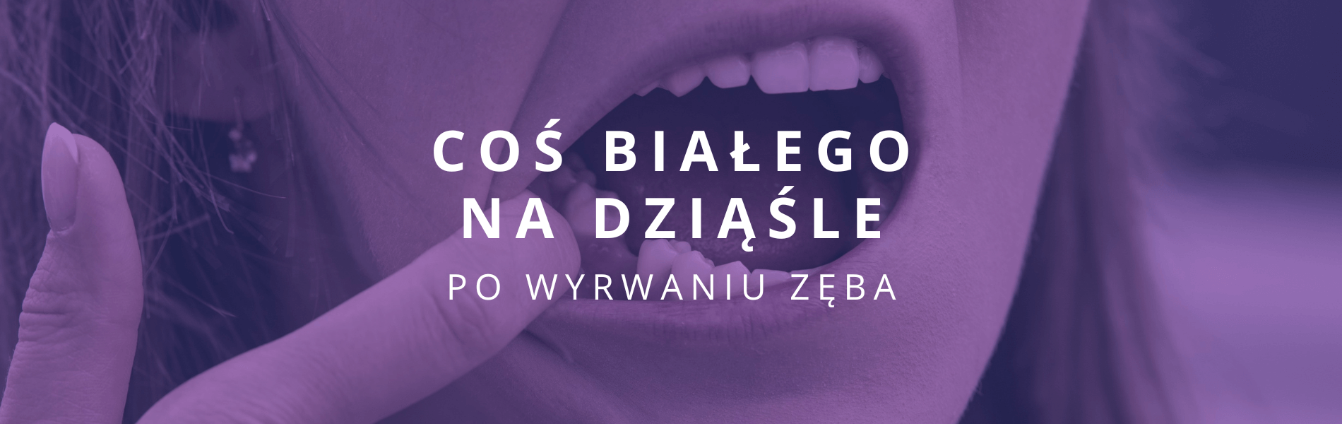 po wyrwaniu zęba widać coś białego