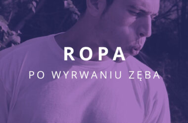 ropa po wyrwaniu zęba