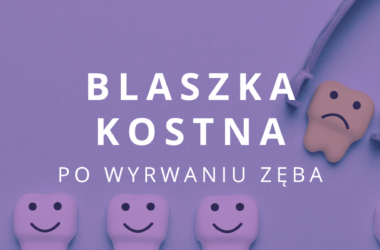 blaszka kostna po wyrwaniu zęba