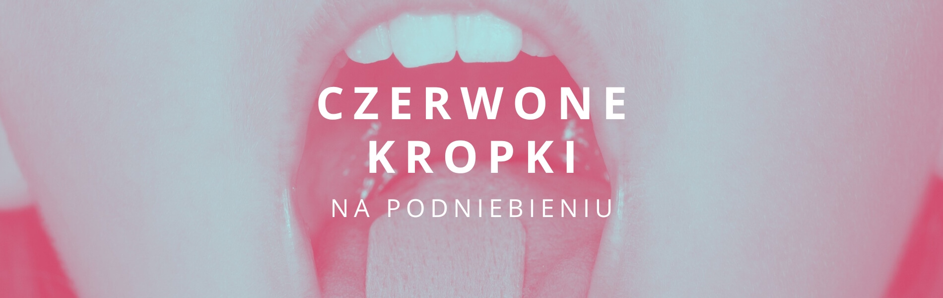 czerwone kropki na podniebieniu