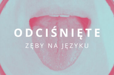 odciśnięte zęby na języku