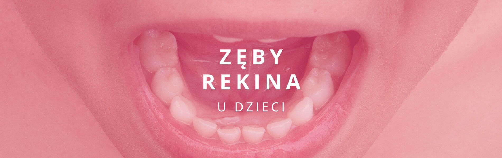 zęby rekina u dzieci