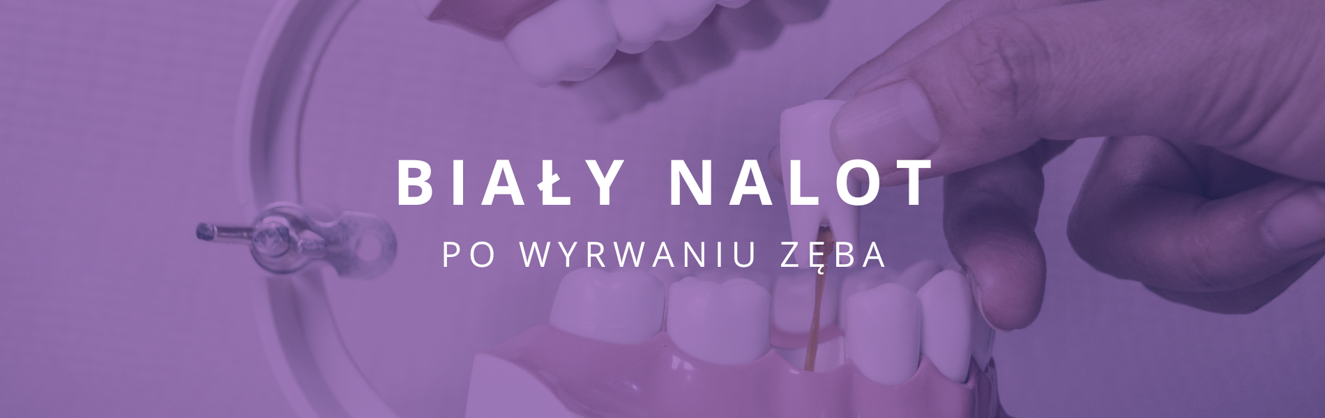 Biały nalot po wyrwaniu zęba