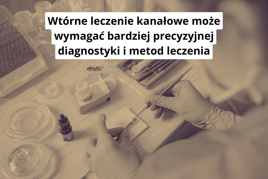 Wtórne leczenie kanałowe może wymagać bardziej precyzyjnej diagnostyki i metod leczenia