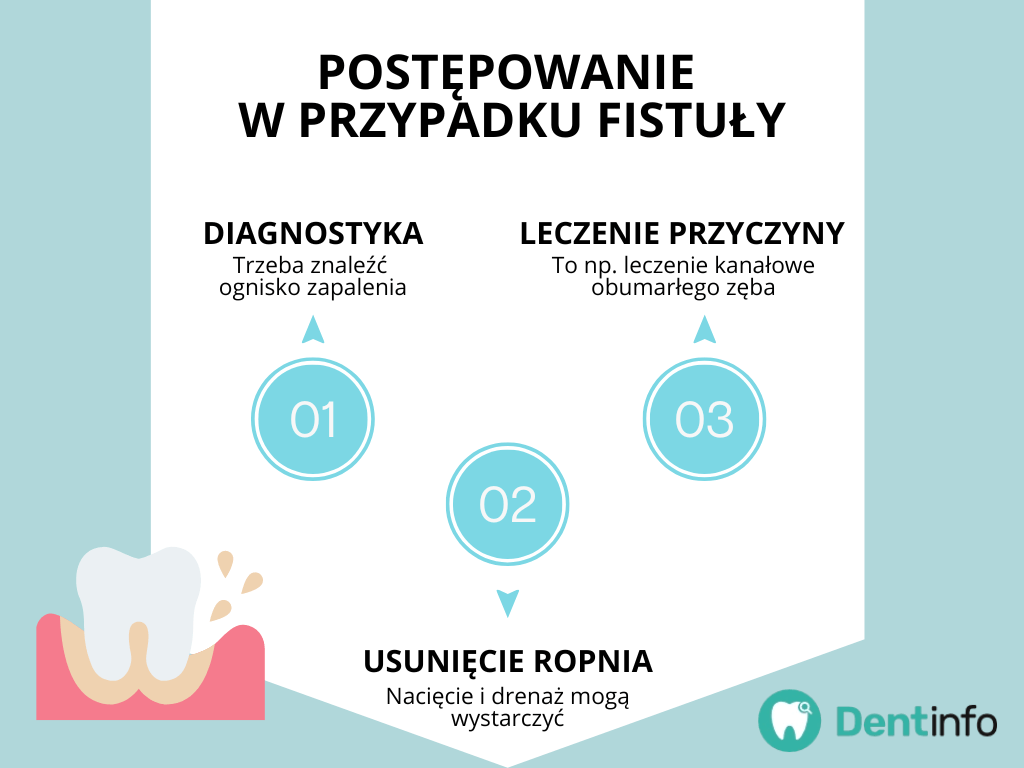 Postępowanie w przypadku fistuły:
1. Diagnostyka – trzeba znaleźć 
ognisko zapalenia.
2. Usunięcie ropnia – nacięcie i drenaż mogą wystarczyć.
3. Leczenie przyczyny – to np. leczenie kanałowe obumarłego zęba.