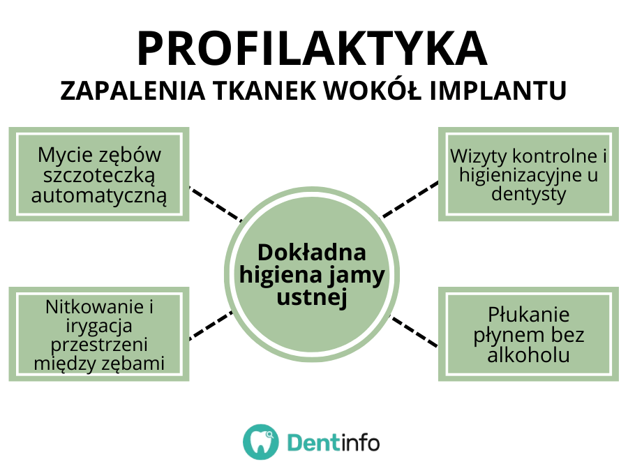 Profilaktyka zapalenia tkanek wokół implantu
1. Mycie zębów szczoteczką automatyczną
2. Nitkowanie i irygacja przestrzeni między zębami
3. Płukanie płynem bez alkoholu
4. Wizyty kontrolne i higienizacyjne u dentysty