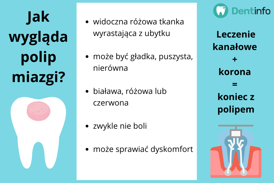 Krótki opis: widoczna różowa tkanka wyrastająca z ubytku; może być gładka, puszysta, nierówna; biaława, różowa lub czerwona; zwykle nie boli; może sprawiać dyskomfort.