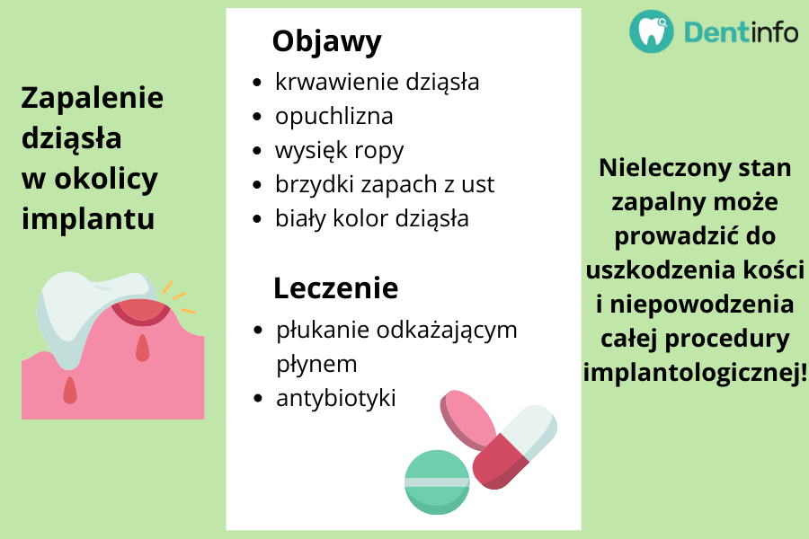 Zapalenie dziąsła w okolicy implantu
Objawy:
- krwawienie dziąsła
- opuchlizna
- wysięk ropy
- brzydki zapach z ust
- biały kolor dziąsła
Leczenie:
- płukanie odkażającym płynem
- antybiotyki
Nieleczony stan zapalny może prowadzić do uszkodzenia kości i niepowodzenia całej procedury implantologicznej!