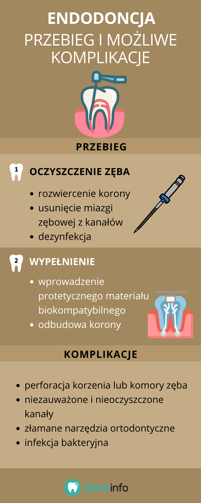 Endodoncja – przebieg i możliwe komplikacje
Przebieg:
1. OCZYSZCZENIE ZĘBA
- rozwiercenie korony
- usunięcie miazgi zębowej z kanałów
- dezynfekcja
2. WYPEŁNIENIE
- wprowadzenie protetycznego materiału biokompatybilnego
- odbudowa korony
Komplikacje:
- perforacja korzenia lub komory zęba
- niezauważone i nieoczyszczone kanały
- złamane narzędzia ortodontyczne
- infekcja bakteryjna