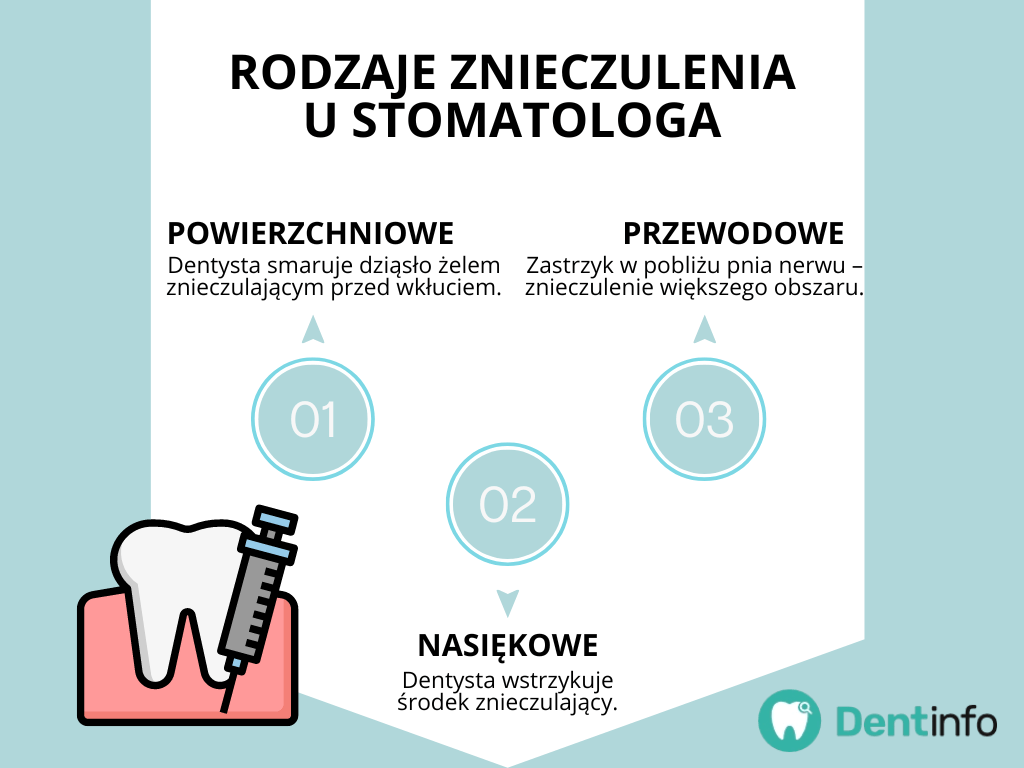 Rodzaje znieczulenia u stomatologa
1. Powierzchniowe – Dentysta smaruje dziąsło żelem znieczulającym przed wkłuciem.
2. Nasiękowe – Dentysta wstrzykuje
środek znieczulający.
3. Zastrzyk w pobliżu pnia nerwu – znieczulenie większego obszaru.