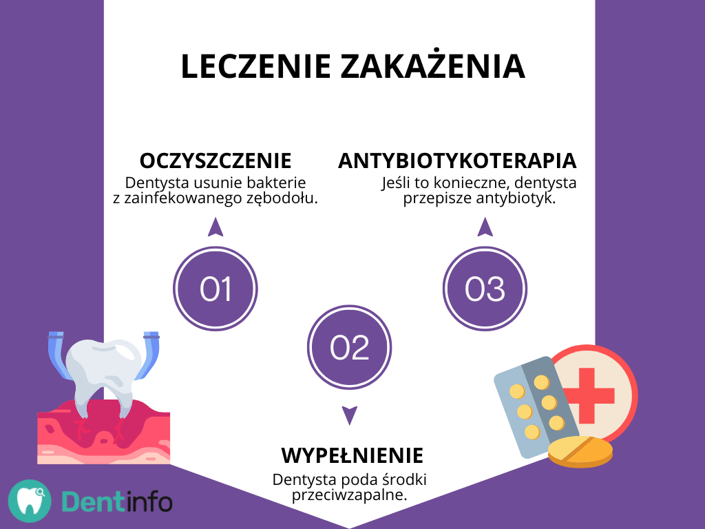 Leczenie zakażenia w skrócie:
1. oczyszczenie
2. wypełnienie
3. antybiotykoterapia.