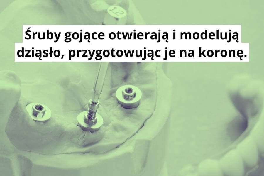 Śruby gojące otwierają i modelują dziąsło, przygotowując je na koronę.