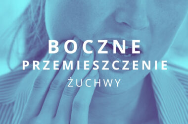 boczne przemieszczenie żuchwy