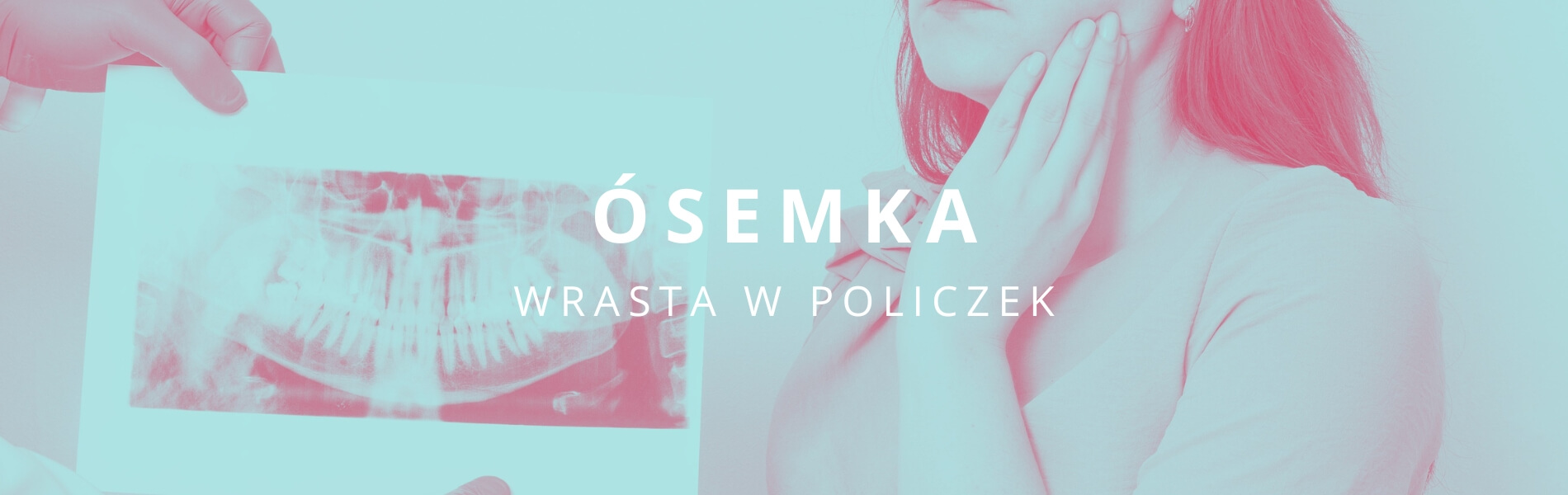 ósemka wrasta w policzek