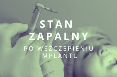 stan zapalny po wszczepieniu implantu