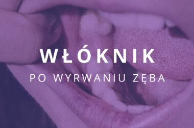 włóknik po wyrwaniu zęba jak wygląda