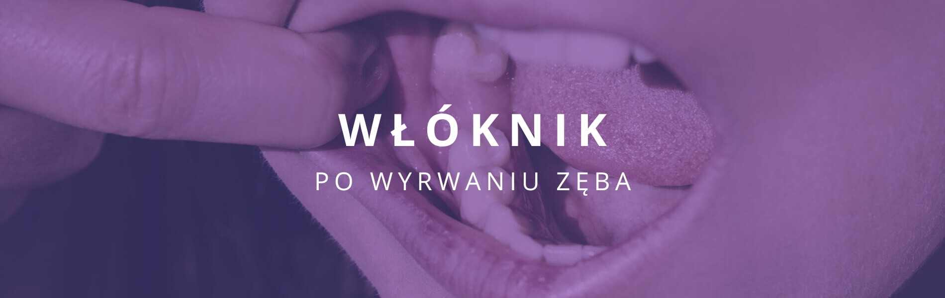 włóknik po wyrwaniu zęba jak wygląda