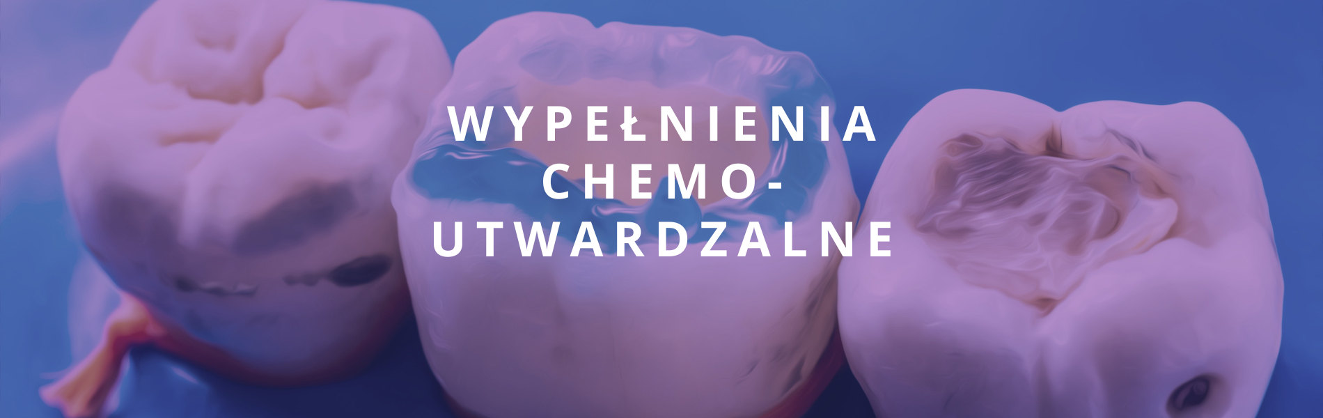 wypełnienia chemoutwardzalne