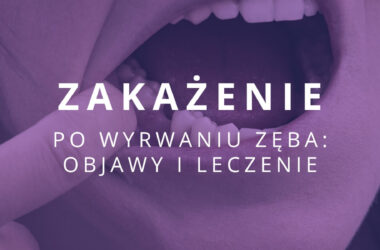 zakażenie po wyrwaniu zęba objawy