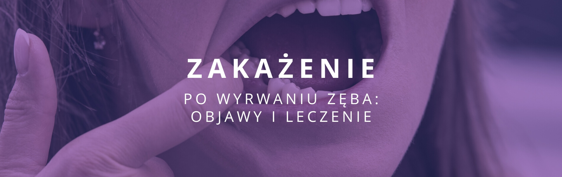 zakażenie po wyrwaniu zęba objawy