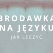 brodawka na języku