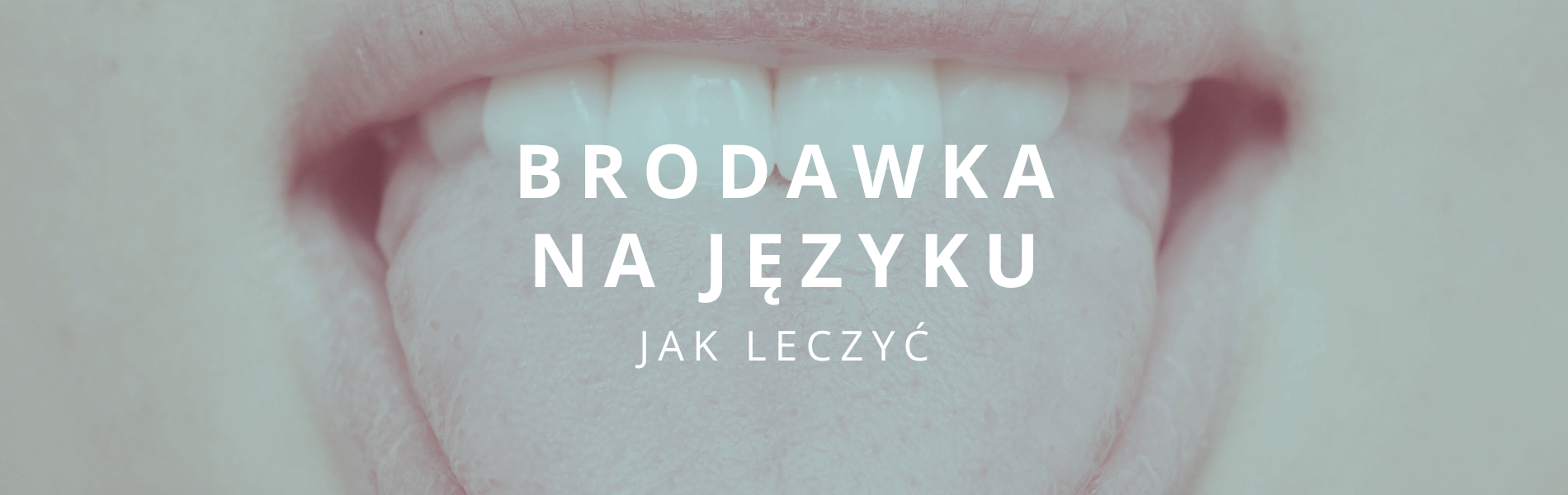 brodawka na języku